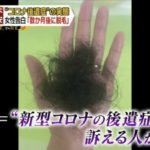 コロナで脱毛したのですが、医療用ウイッグで自然に出来ますか？